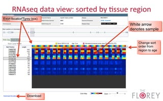 RNAseq	
  data	
  view:	
  sorted	
  by	
  2ssue	
  region	
  
Exon location (grey box)
White arrow
denotes sample
Change sort
order from
region to age
Download
 