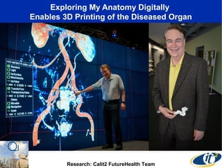 Exploring My Anatomy Digitally
Enables 3D Printing of the Diseased Organ

Research: Calit2 FutureHealth Team

 