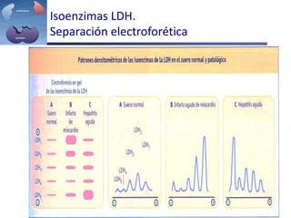 Isoenzimas LDH.
Separación electroforética
 