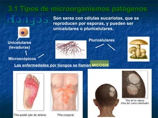 3.1 Tipos de microorganismos patógenos Hongos Son seres con células eucariotas, que se reproducen por esporas, y pueden ser unicelulares o pluricelulares. Unicelulares (levaduras) Pluricelulares Las enfermedades por hongos se llaman  MICOSIS Microscópicos 