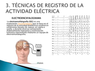 ELECTROENCEFALOGRAMA,[object Object],La electroencefalografía (EEG) es una exploración neurofisiológica que se basa en el registro de la actividad bioeléctrica cerebral en condiciones basales de reposo, en vigilia o sueño, y durante diversas activaciones (habitualmente hiperpnea y estimulación luminosa intermitente) mediante un equipo de electroencefalografia. ,[object Object],3. TÉCNICAS DE REGISTRO DE LA ACTIVIDAD ELÉCTRICA,[object Object]