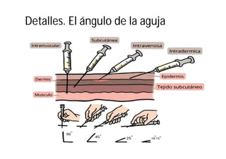 Detalles. El ángulo de la aguja
 