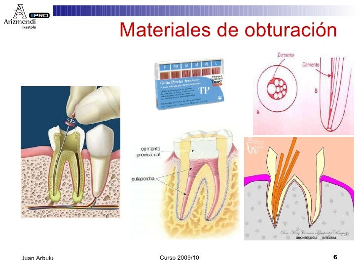 Ud6materiales dentales