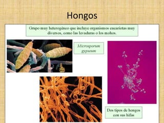 Hongos
 
