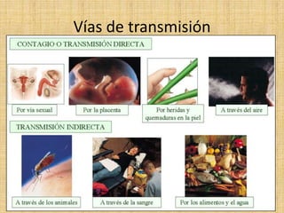 Vías de transmisión
 