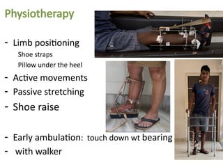 Heel Ambulation Example Ilizarov surgeyr Post-op Care final.pptx