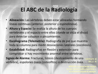 Abc Radiografía Guía Completa para la Evaluación Radiológica de la Columna Vertebral | PPTX