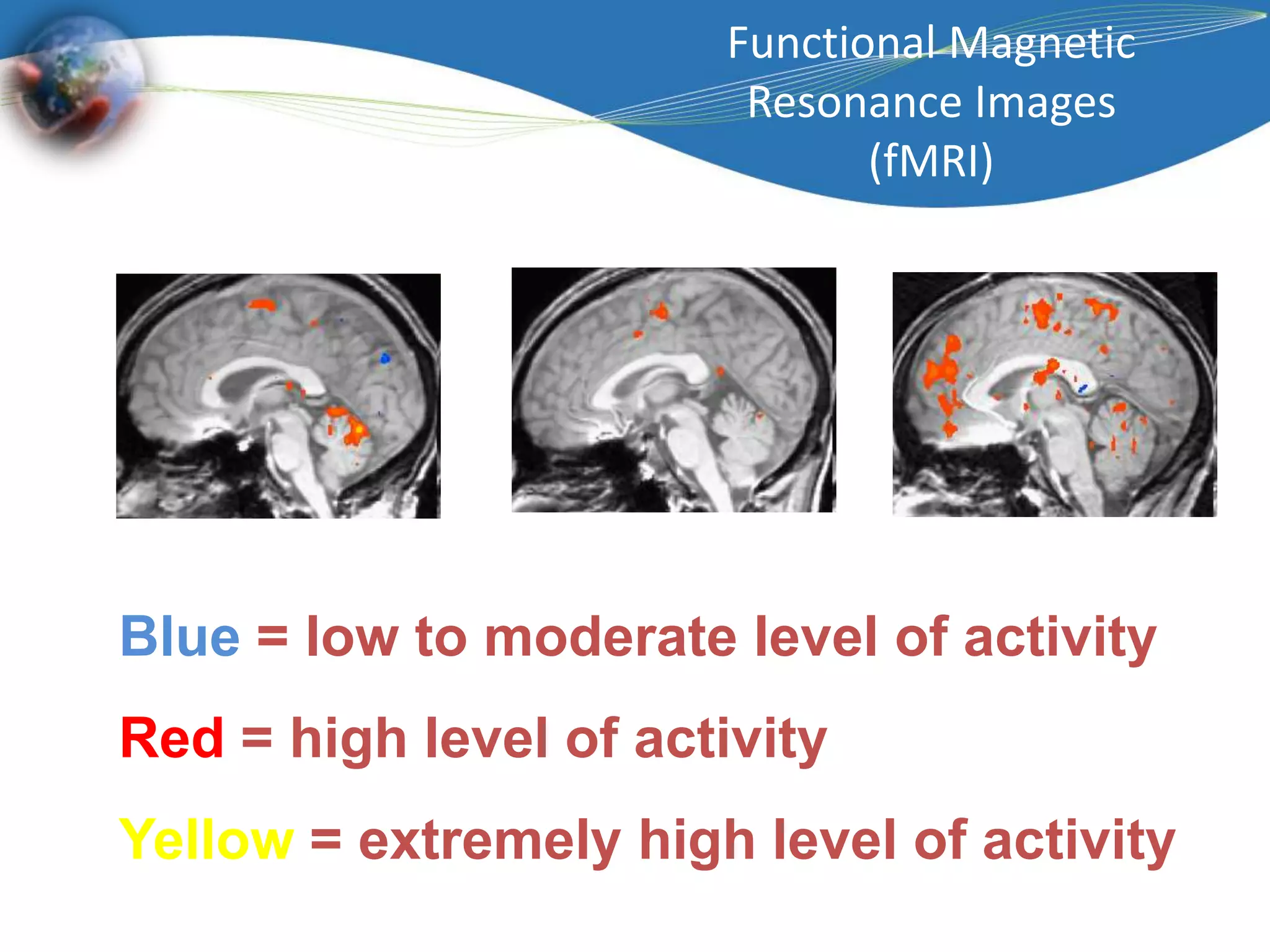 Functional Magnetic Resonance Images (fMRI) Blue = low to moderate level of activity Red = high level of activityYellow = extremely high level of activity 