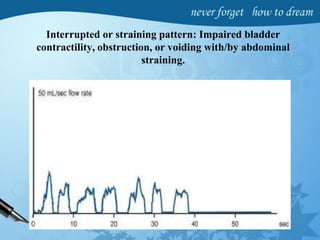 Interrupted or straining pattern: Impaired bladder
contractility, obstruction, or voiding with/by abdominal
straining.
 
