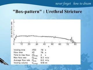 "Box-pattern" : Urethral Stricture
 