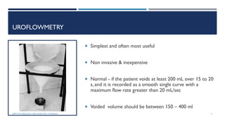 UROFLOWMETRY
 Simplest and often most useful
 Non invasive & inexpensive
 Normal - if the patient voids at least 200 mL over 15 to 20
s, and it is recorded as a smooth single curve with a
maximum flow rate greater than 20 mL/sec
 Voided volume should be between 150 – 400 ml
11
DEPT OF UROLOGY, GRH AND KMC, CHENNAI.
 