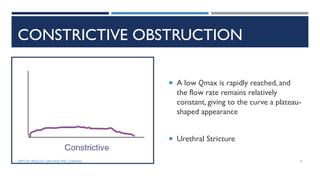 CONSTRICTIVE OBSTRUCTION
 A low Qmax is rapidly reached, and
the flow rate remains relatively
constant, giving to the curve a plateau-
shaped appearance
 Urethral Stricture
15
DEPT OF UROLOGY, GRH AND KMC, CHENNAI.
 