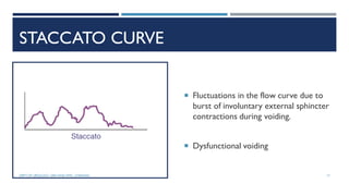STACCATO CURVE
 Fluctuations in the flow curve due to
burst of involuntary external sphincter
contractions during voiding.
 Dysfunctional voiding
17
DEPT OF UROLOGY, GRH AND KMC, CHENNAI.
 