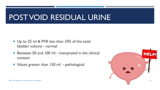 POSTVOID RESIDUAL URINE
 Up to 25 ml & PVR less than 10% of the total
bladder volume - normal
 Between 50 and 100 ml - interpreted in the clinical
context
 Values greater than 150 ml - pathological
20
DEPT OF UROLOGY, GRH AND KMC, CHENNAI.
 