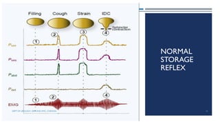 NORMAL
STORAGE
REFLEX
44
DEPT OF UROLOGY, GRH AND KMC, CHENNAI.
 
