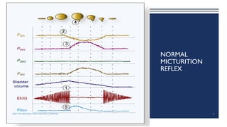 NORMAL
MICTURITION
REFLEX
45
DEPT OF UROLOGY, GRH AND KMC, CHENNAI.
 