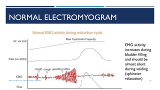 NORMAL ELECTROMYOGRAM
EMG activity
increases during
bladder filling
and should be
almost silent
during voiding
(sphincter
relaxation) 87
DEPT OF UROLOGY, GRH AND KMC, CHENNAI.
 