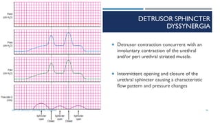 DETRUSOR SPHINCTER
DYSSYNERGIA
 Detrusor contraction concurrent with an
involuntary contraction of the urethral
and/or peri urethral striated muscle.
 Intermittent opening and closure of the
urethral sphincter causing a characteristic
flow pattern and pressure changes
94
DEPT OF UROLOGY, GRH AND KMC, CHENNAI.
 
