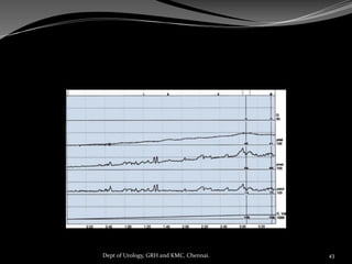 43
Dept of Urology, GRH and KMC, Chennai.
 