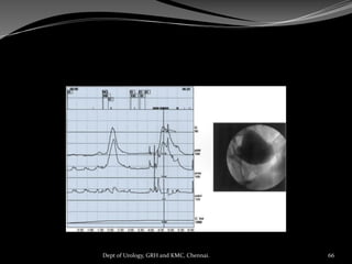 66
Dept of Urology, GRH and KMC, Chennai.
 