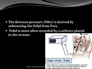  The detrusor pressure (Pdet) is derived by
subtracting the Pabd from Pves.
 Pabd is most often recorded by a catheter placed
in the rectum.
76
Dept of Urology, GRH and KMC, Chennai.
 