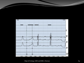 84
Dept of Urology, GRH and KMC, Chennai.
 