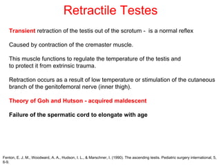 Retractile Testes
Transient retraction of the testis out of the scrotum - is a normal reflex
Caused by contraction of the cremaster muscle.
This muscle functions to regulate the temperature of the testis and
to protect it from extrinsic trauma.
Retraction occurs as a result of low temperature or stimulation of the cutaneous
branch of the genitofemoral nerve (inner thigh).
Theory of Goh and Hutson - acquired maldescent
Failure of the spermatic cord to elongate with age
Fenton, E. J. M., Woodward, A. A., Hudson, I. L., & Marschner, I. (1990). The ascending testis. Pediatric surgery international, 5,
6-9.
 