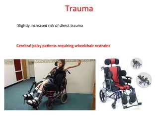 Trauma
Slightly increased risk of direct trauma
Cerebral palsy patients requiring wheelchair restraint
 