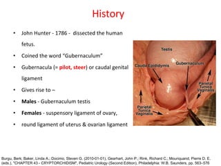 History
• John Hunter - 1786 - dissected the human
fetus.
• Coined the word “Gubernaculum”
• Gubernacula (= pilot, steer) or caudal genital
ligament
• Gives rise to –
• Males - Gubernaculum testis
• Females - suspensory ligament of ovary,
• round ligament of uterus & ovarian ligament
Burgu, Berk; Baker, Linda A.; Docimo, Steven G. (2010-01-01), Gearhart, John P.; Rink, Richard C.; Mouriquand, Pierre D. E.
(eds.), "CHAPTER 43 - CRYPTORCHIDISM", Pediatric Urology (Second Edition), Philadelphia: W.B. Saunders, pp. 563–576
 