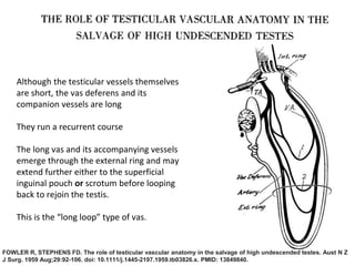 Fowler & Stephens “Long Loop Vas” Orchidopexy
Although the testicular vessels themselves
are short, the vas deferens and its
companion vessels are long
They run a recurrent course
The long vas and its accompanying vessels
emerge through the external ring and may
extend further either to the superficial
inguinal pouch or scrotum before looping
back to rejoin the testis.
This is the “long loop” type of vas.
FOWLER R, STEPHENS FD. The role of testicular vascular anatomy in the salvage of high undescended testes. Aust N Z
J Surg. 1959 Aug;29:92-106. doi: 10.1111/j.1445-2197.1959.tb03826.x. PMID: 13849840.
 