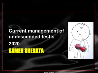 SAMEH SHEHATA
Current management of
undescended testis
2020
 
