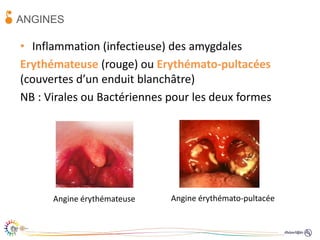 UE25_Chardon_MaladiesInfectieusesORL.pdf