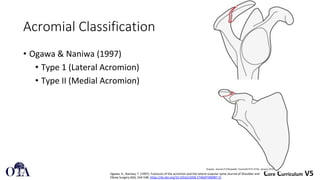 Scapula Fractures classification and manegment | PDF