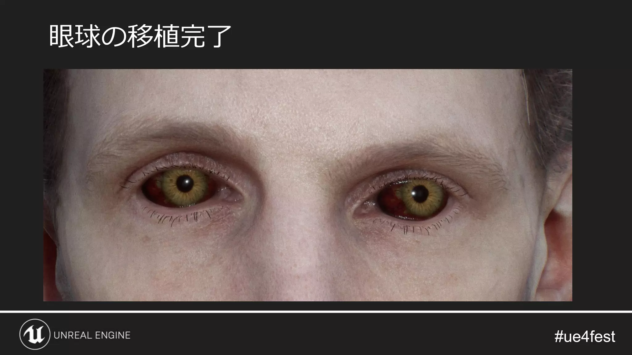 #ue4fest#ue4fest
眼球の移植完了
 