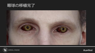 #ue4fest#ue4fest
眼球の移植完了
 