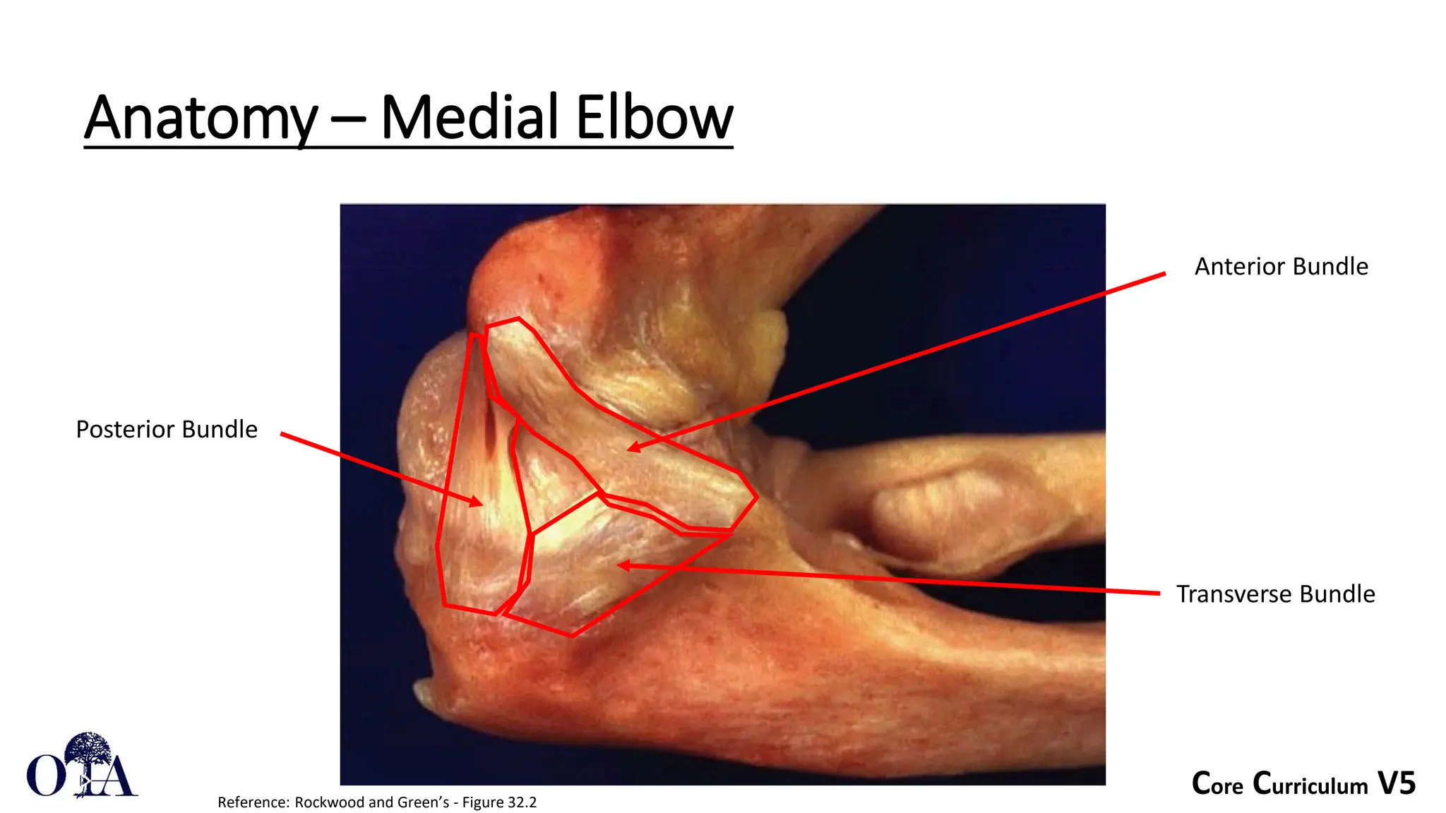 Core Curriculum V5
Anatomy – Medial Elbow
Reference: Rockwood and Green’s - Figure 32.2
Anterior Bundle
Transverse Bundle
Posterior Bundle
 