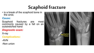 Scaphoid fracture
• is a break of the scaphoid bone in
the wrist.
Cause:
Scaphoid fractures are most
commonly caused by a fall on an
outstretched hand
Diagnostic exam:
X-ray
Complications:
-AVN
-Non union
 