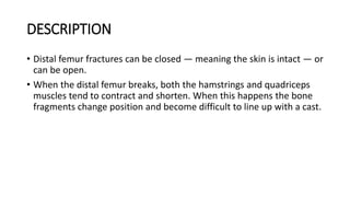 DESCRIPTION
• Distal femur fractures can be closed — meaning the skin is intact — or
can be open.
• When the distal femur breaks, both the hamstrings and quadriceps
muscles tend to contract and shorten. When this happens the bone
fragments change position and become difficult to line up with a cast.
 