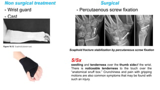 Non surgical treatment Surgical
- Wrist guard - Percutaenous screw fixation
- Cast
Scaphoid fracture stabilization by percutaneous screw fixation
S/Sx
swelling and tenderness over the thumb sideof the wrist.
There is noticeable tenderness to the touch over the
“anatomical snuff box.” Crunchiness and pain with gripping
motions are also common symptoms that may be found with
such an injury.
 