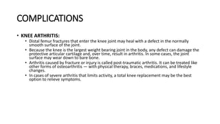COMPLICATIONS
• KNEE ARTHRITIS:
• Distal femur fractures that enter the knee joint may heal with a defect in the normally
smooth surface of the joint.
• Because the knee is the largest weight bearing joint in the body, any defect can damage the
protective articular cartilage and, over time, result in arthritis. In some cases, the joint
surface may wear down to bare bone.
• Arthritis caused by fracture or injury is called post-traumatic arthritis. It can be treated like
other forms of osteoarthritis — with physical therapy, braces, medications, and lifestyle
changes.
• In cases of severe arthritis that limits activity, a total knee replacement may be the best
option to relieve symptoms.
 