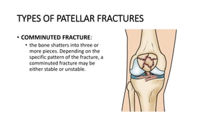 TYPES OF PATELLAR FRACTURES
• COMMINUTED FRACTURE:
• the bone shatters into three or
more pieces. Depending on the
specific pattern of the fracture, a
comminuted fracture may be
either stable or unstable.
 