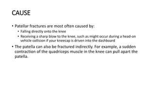 CAUSE
• Patellar fractures are most often caused by:
• Falling directly onto the knee
• Receiving a sharp blow to the knee, such as might occur during a head-on
vehicle collision if your kneecap is driven into the dashboard
• The patella can also be fractured indirectly. For example, a sudden
contraction of the quadriceps muscle in the knee can pull apart the
patella.
 
