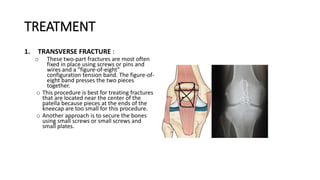 TREATMENT
1. TRANSVERSE FRACTURE :
o These two-part fractures are most often
fixed in place using screws or pins and
wires and a "figure-of-eight"
configuration tension band. The figure-of-
eight band presses the two pieces
together.
o This procedure is best for treating fractures
that are located near the center of the
patella because pieces at the ends of the
kneecap are too small for this procedure.
o Another approach is to secure the bones
using small screws or small screws and
small plates.
 