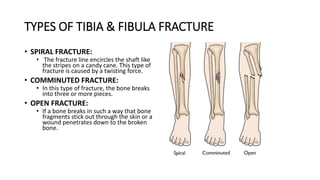 TYPES OF TIBIA & FIBULA FRACTURE
• SPIRAL FRACTURE:
• The fracture line encircles the shaft like
the stripes on a candy cane. This type of
fracture is caused by a twisting force.
• COMMINUTED FRACTURE:
• In this type of fracture, the bone breaks
into three or more pieces.
• OPEN FRACTURE:
• If a bone breaks in such a way that bone
fragments stick out through the skin or a
wound penetrates down to the broken
bone.
 