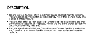 DESCRIPTION
• Toe and forefoot fractures often result from trauma or direct injury to the bone.
Fractures can also develop after repetitive activity, rather than a single injury. This
is called a "stress fracture."
• Fractures may either be "non-displaced," where the bone is cracked but the ends
of the bone are together, or "displaced," where the end of the broken bones have
partially or completely separated.
• Fractures can also be divided into "closed fractures" where the skin is not broken
and "open fractures" where the skin is broken and the wound extends down to
the bone.
 