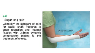 Tx:
- Sugar tong splint
Generally the standard of care
for radial shaft fractures is
open reduction and internal
fixation with 3.5mm dynamic
compression plating is the
treatment of choice.
 