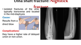 Ulna shaft fracture: Nighstick
fracture• isolated fractures of the ulna,
typically transverse and located
in the mid-diaphysis
Cause:
Results from a
direct blow
Complications:
they have a higher rate of delayed
union or non-union.
 