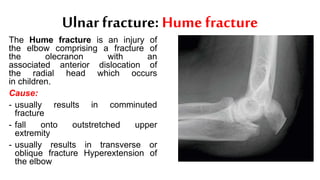 Ulnar fracture: Hume fracture
The Hume fracture is an injury of
the elbow comprising a fracture of
the olecranon with an
associated anterior dislocation of
the radial head which occurs
in children.
Cause:
- usually results in comminuted
fracture
- fall onto outstretched upper
extremity
- usually results in transverse or
oblique fracture Hyperextension of
the elbow
 