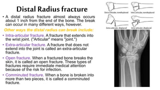 Distal Radius fracture
• A distal radius fracture almost always occurs
about 1 inch from the end of the bone. The break
can occur in many different ways, however.
Other ways the distal radius can break include:
• Intra-articular fracture. A fracture that extends into
the wrist joint. ("Articular" means "joint.")
• Extra-articular fracture. A fracture that does not
extend into the joint is called an extra-articular
fracture.
• Open fracture. When a fractured bone breaks the
skin, it is called an open fracture. These types of
fractures require immediate medical attention
because of the risk for infection.
• Comminuted fracture. When a bone is broken into
more than two pieces, it is called a comminuted
fracture.
 