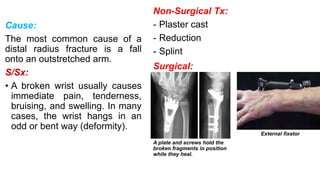 Cause:
The most common cause of a
distal radius fracture is a fall
onto an outstretched arm.
S/Sx:
• A broken wrist usually causes
immediate pain, tenderness,
bruising, and swelling. In many
cases, the wrist hangs in an
odd or bent way (deformity).
Non-Surgical Tx:
- Plaster cast
- Reduction
- Splint
Surgical:
A plate and screws hold the
broken fragments in position
while they heal.
External fixator
 